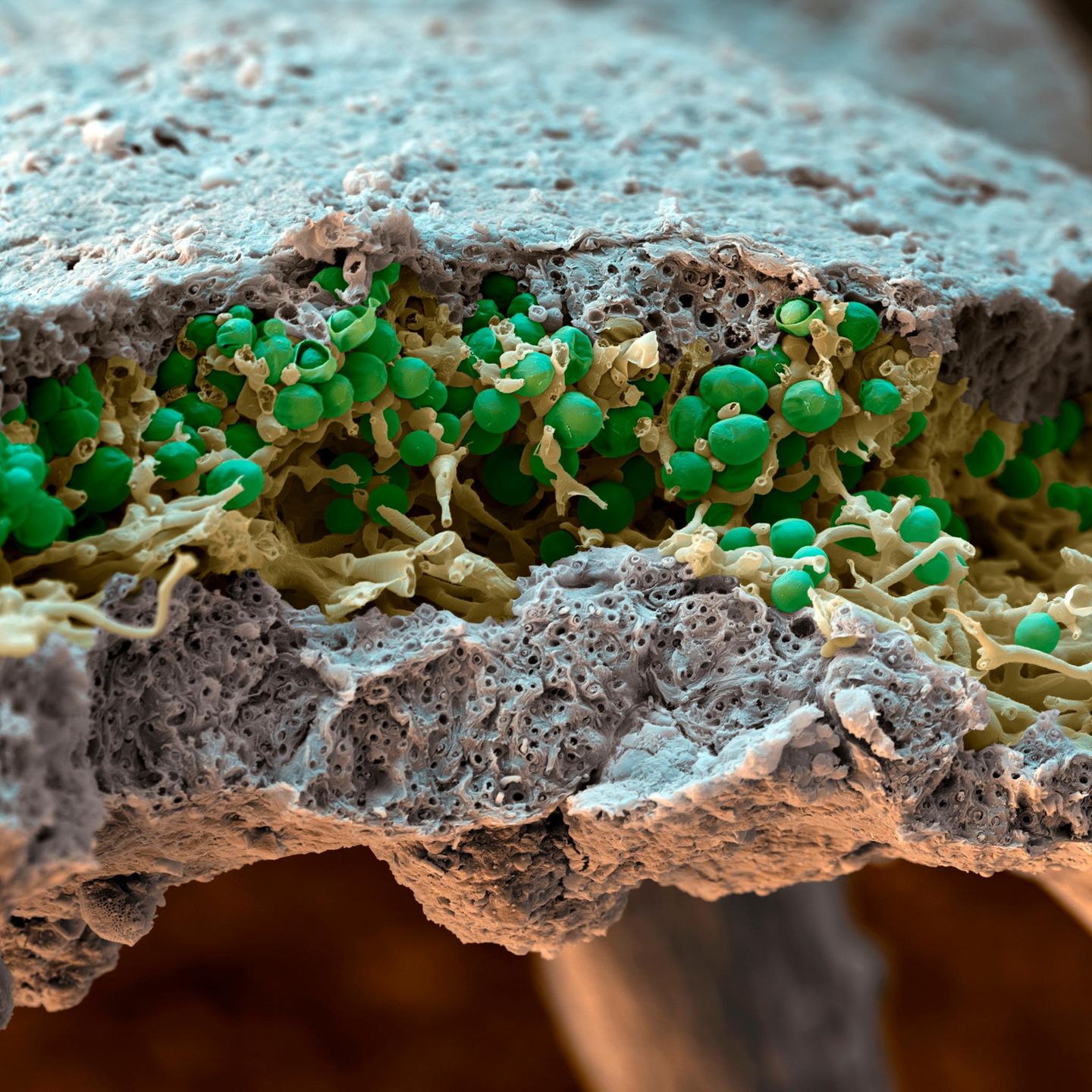 Querschnitt einer Flechte Rosette lichen. Coloured scanning electron micrograph (SEM) of a section through a rosette lichen (Physcia adscendens). Lichens are organisms formed by the symbiotic association of a fungus (blue-grey) and an alga (green spheres) or cyanobacterium. The algal cells use photosynthesis to produce nutrients which are absorbed by a mesh of fungal hyphae that surround and penetrate the algae. Fungal hyp