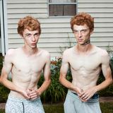 Zwillinge mit roten Haareen stehen oberkörperfrei nebeneinander