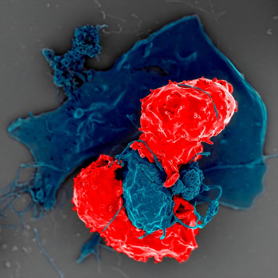 Regulatorische T-Zellen (rot) unter dem Rasterelektronenmikroskop. Die blau eingefärbte Zelle präsentiert ihnen Antigene: Moleküle, auf die das Immunsystem reagieren kann