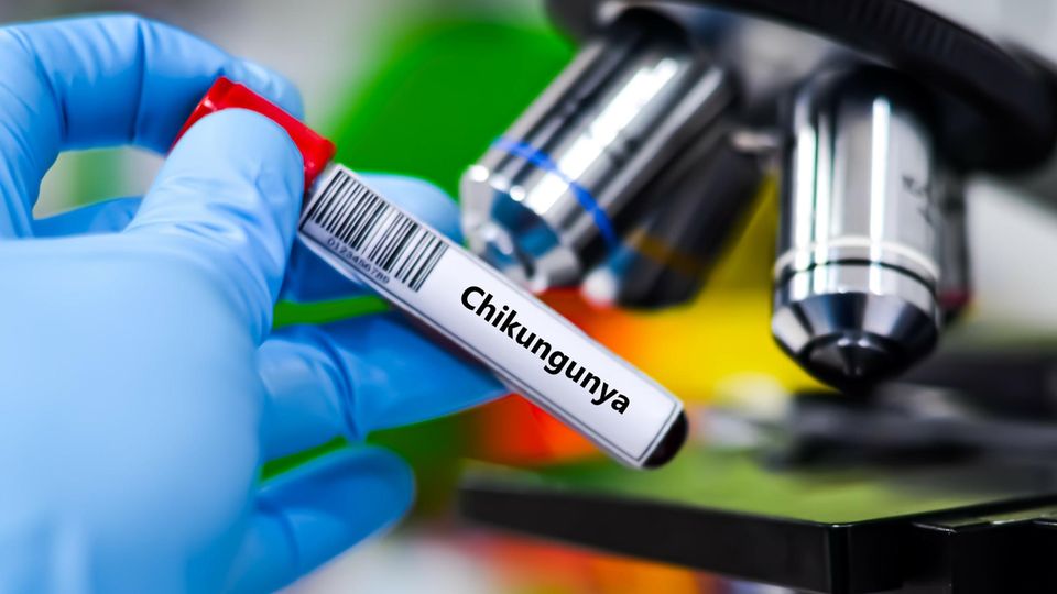 Blutprobenröhrchen für die Chikungunya-Virus-Testanalyse