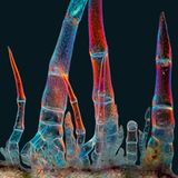 Trichome einer Sonnenblume