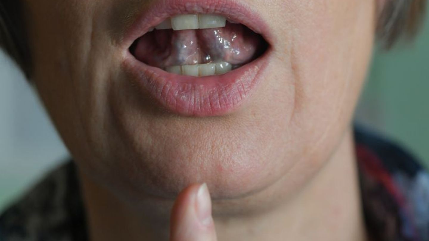 Stotternde Menschen können mit Hilfe von regelmäßigen Sprechübungen ihren Redefluss verbessern. (Symbolbild) Foto: Jens Kalaene/