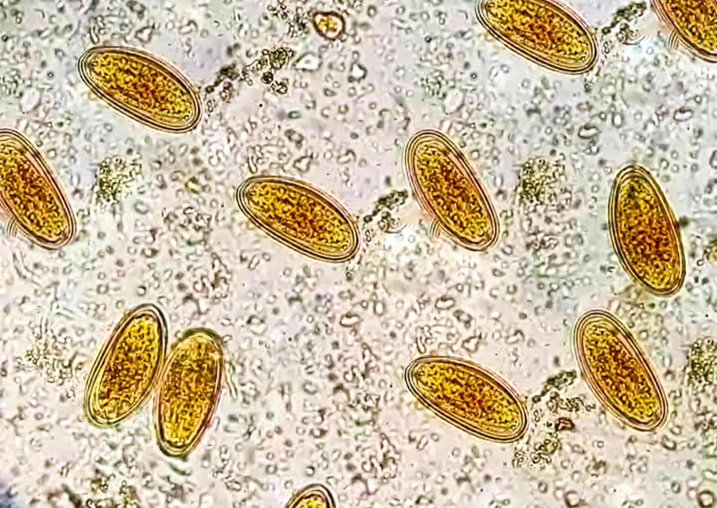 Mikroskopische Aufnahme von Mademwurmeiern, gelb eingefärbt.
