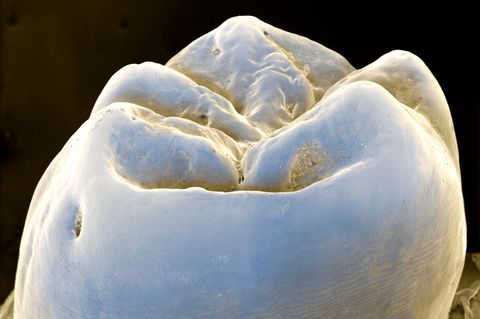 Mikroskopaufnahme eines Backenzahns