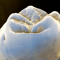 Mikroskopaufnahme eines Backenzahns