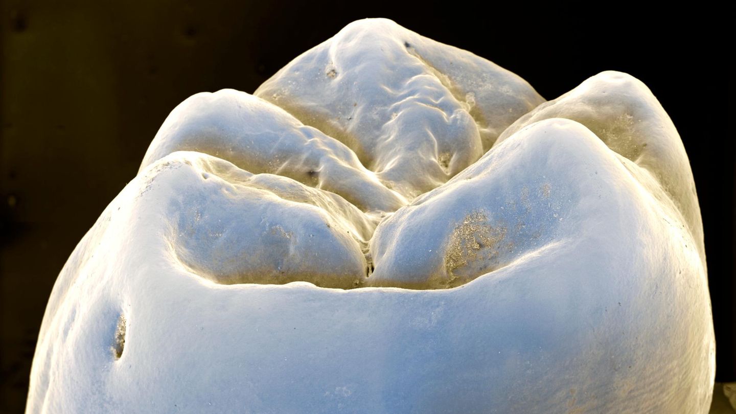 Mundgesundheit-Nie-mehr-Karies-Reparierendes-Gel-l-sst-Zahnschmelz-nachwachsen