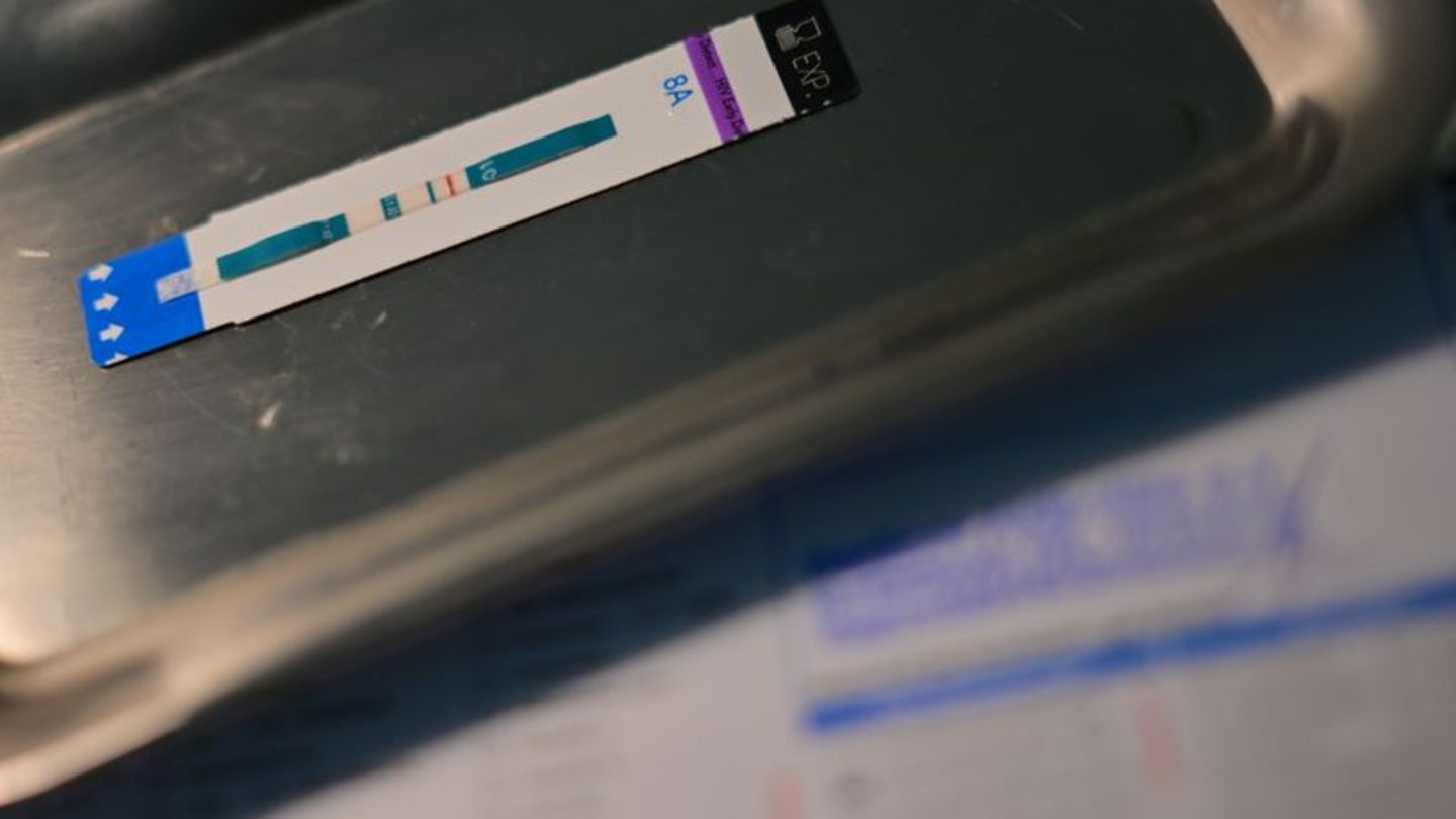 HIV-Diagnosen werden oft erst Jahre nach der Infektion gestellt. (Symbolbild) Foto: Sebastian Gollnow/dpa