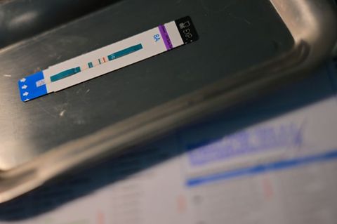 HIV-Diagnosen werden oft erst Jahre nach der Infektion gestellt. (Symbolbild) Foto: Sebastian Gollnow/dpa