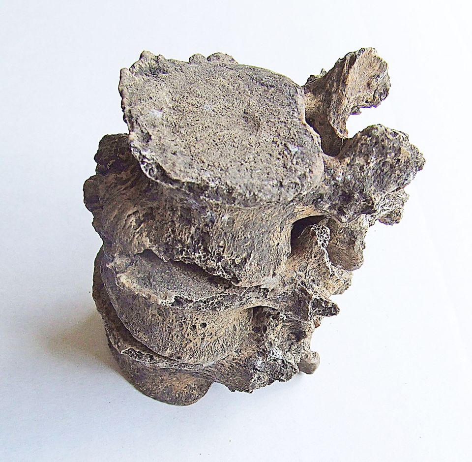 Wirbel eines Skeletts