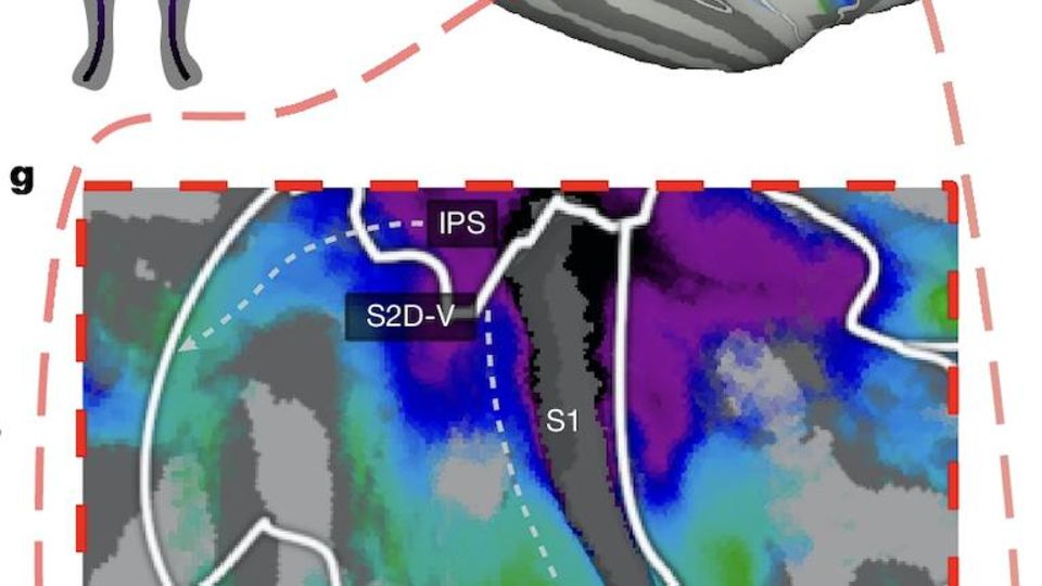 Verschiedene neurowissenschaftliche  Illustrationen des Gehirns