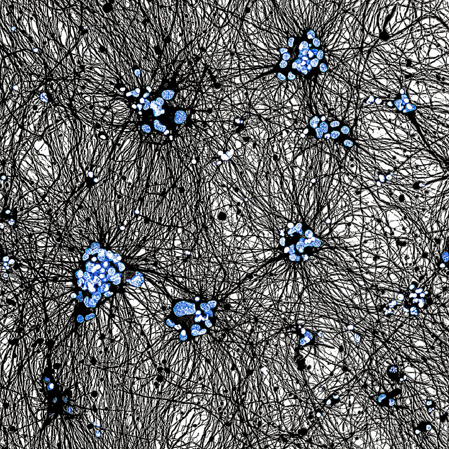 Ein Netzwerk aus filigranen Fasern spannt sich zwischen Nervenzellen