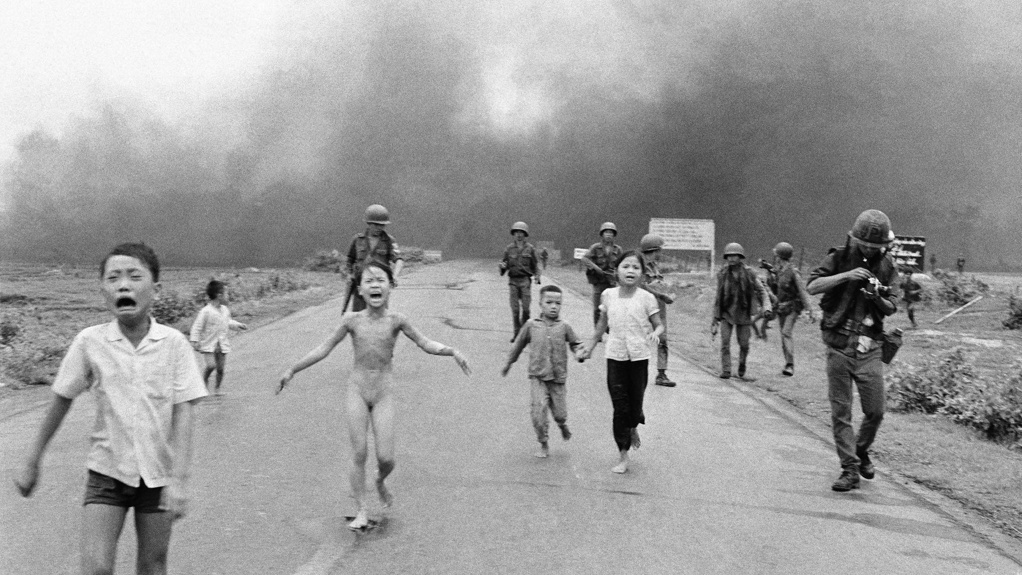 Opfer eines Napalm Angriffs in Vietnam 1972