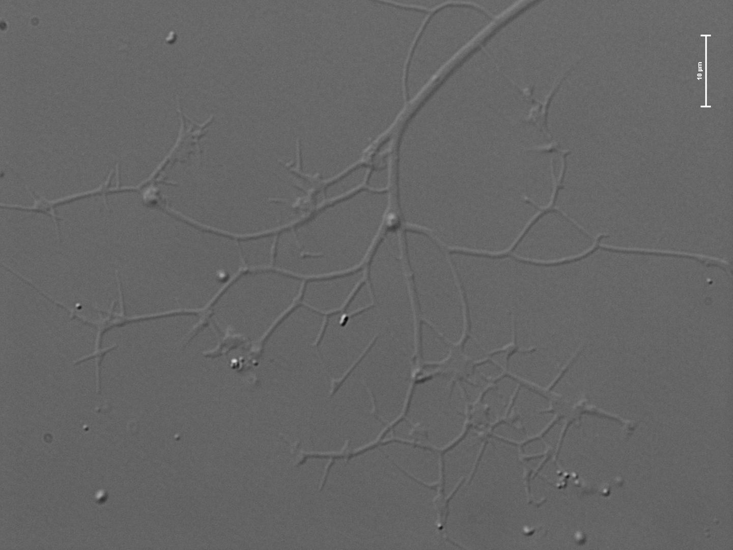 Kraken carinae – Ein Monster unter den Mikroben