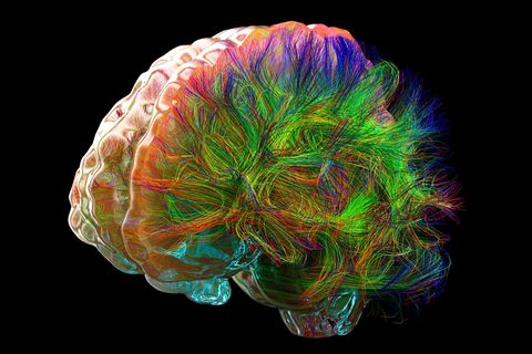 Diese Illustration zeigt die Fasern der Weißen Substanz. Sie sind die Datenautobahnen des Gehirns