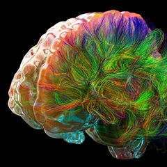 Diese Illustration zeigt die Fasern der Weißen Substanz. Sie sind die Datenautobahnen des Gehirns