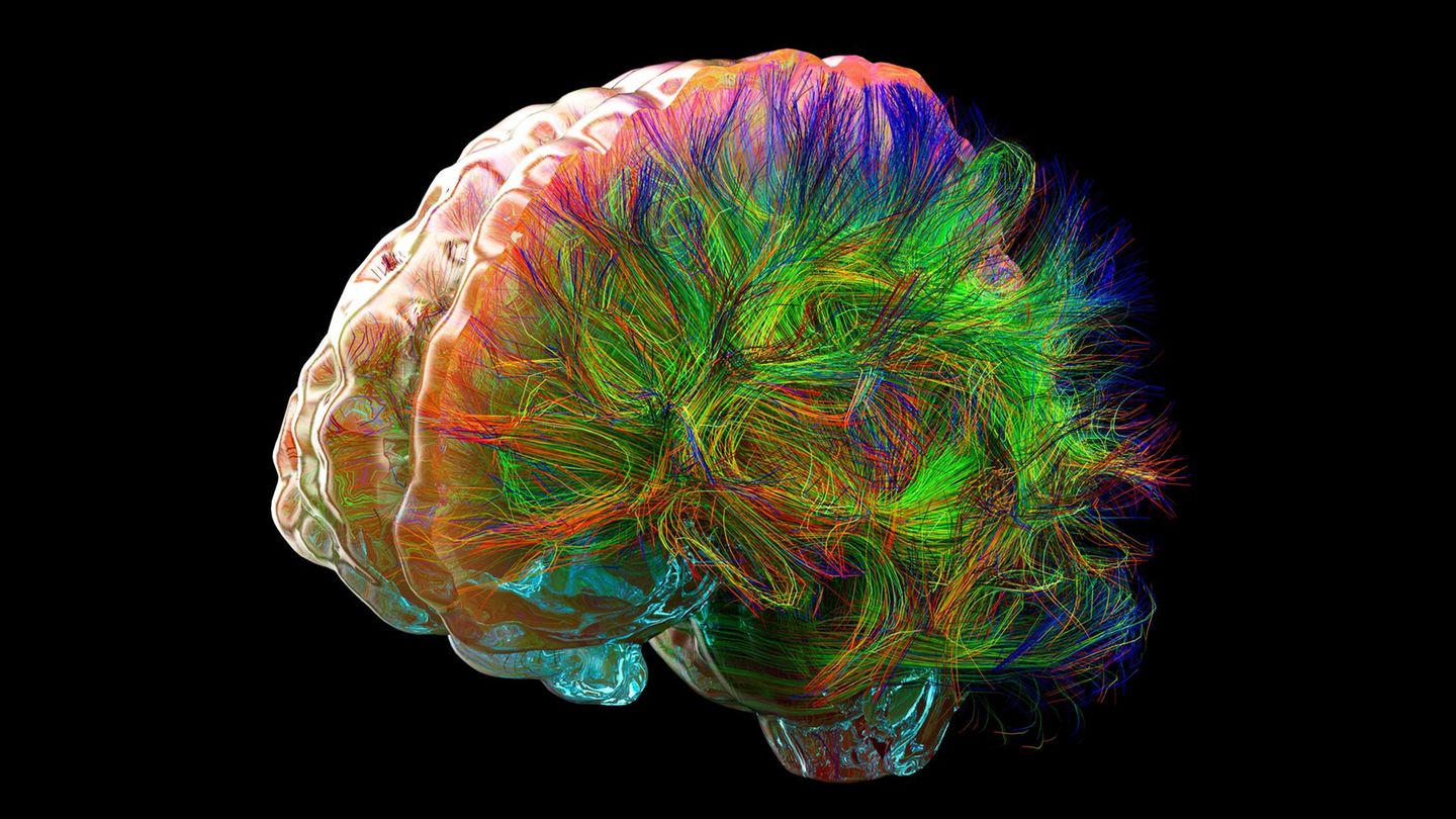 Diese Illustration zeigt die Fasern der Weißen Substanz. Sie sind die Datenautobahnen des Gehirns