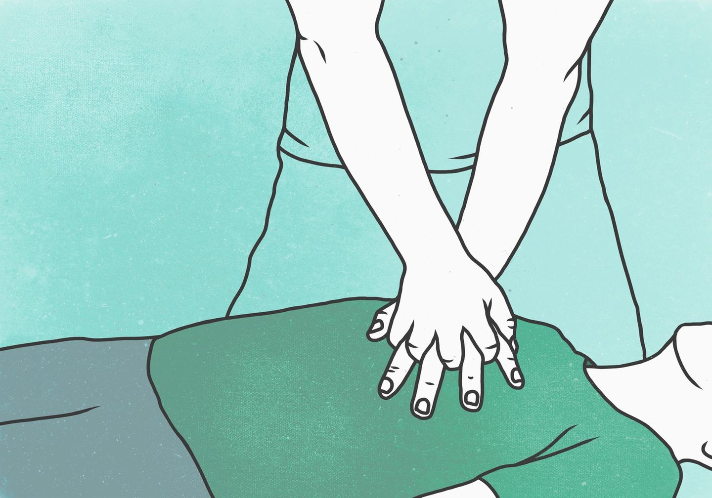 Illustration einer Herzdruckmassage