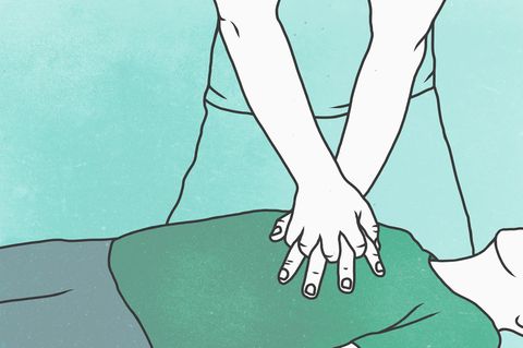 Illustration einer Herzdruckmassage