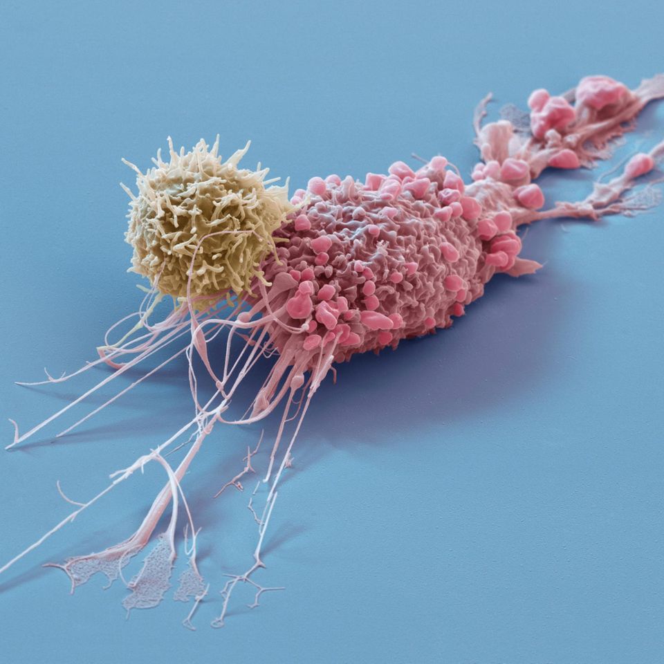 T-Zelle greift Tumorzelle an