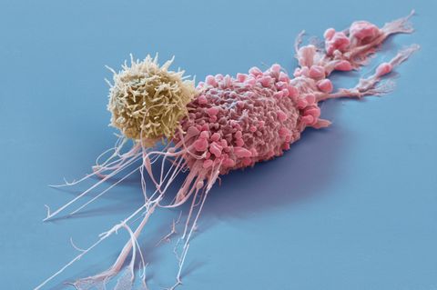 T-Zelle greift Tumorzelle an