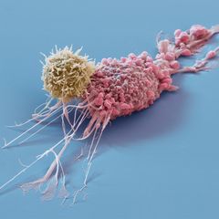 T-Zelle greift Tumorzelle an