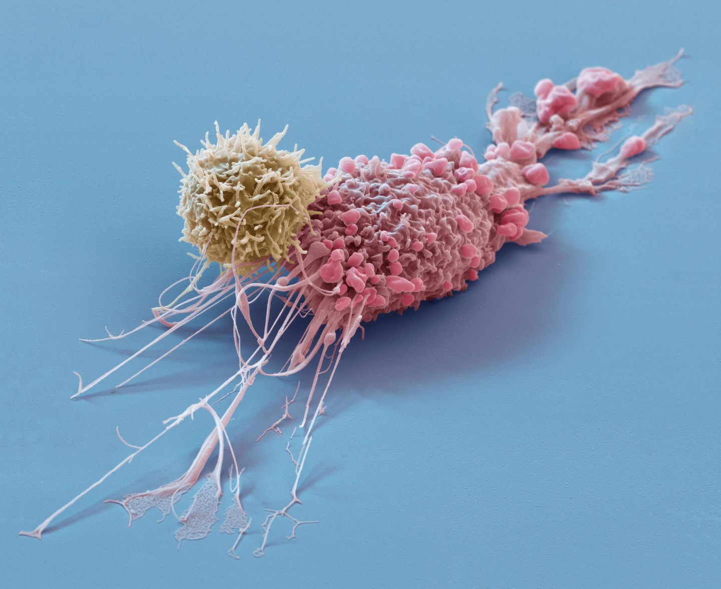 T-Zelle greift Tumorzelle an