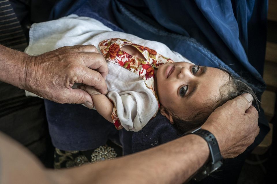 Ein Kind mit der Glasknochenkrankheit