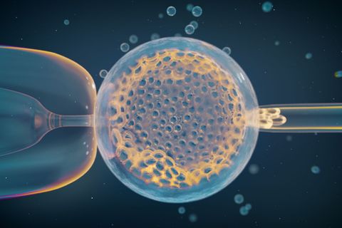 IVF-Embryonenbiopsie für klinische Gentests