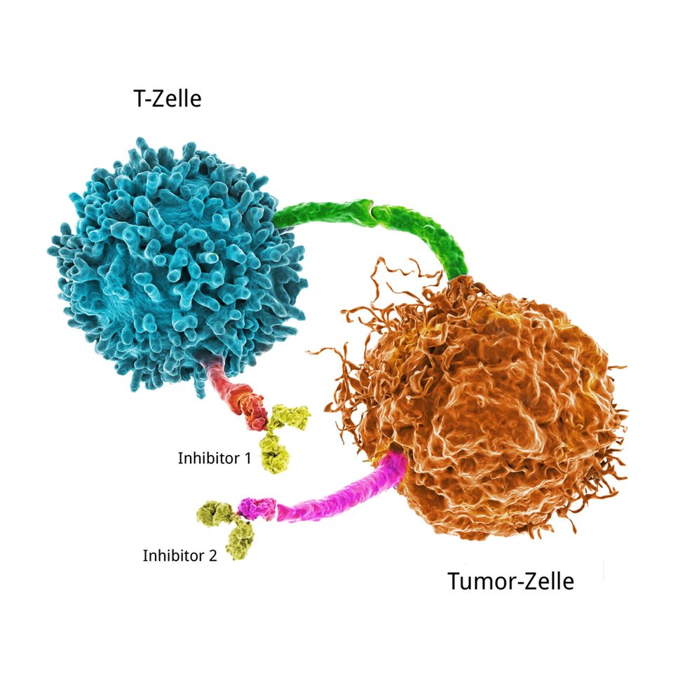 Infografik: Tumorzelle und T-Zelle mit Checkpoint-Inhibitoren