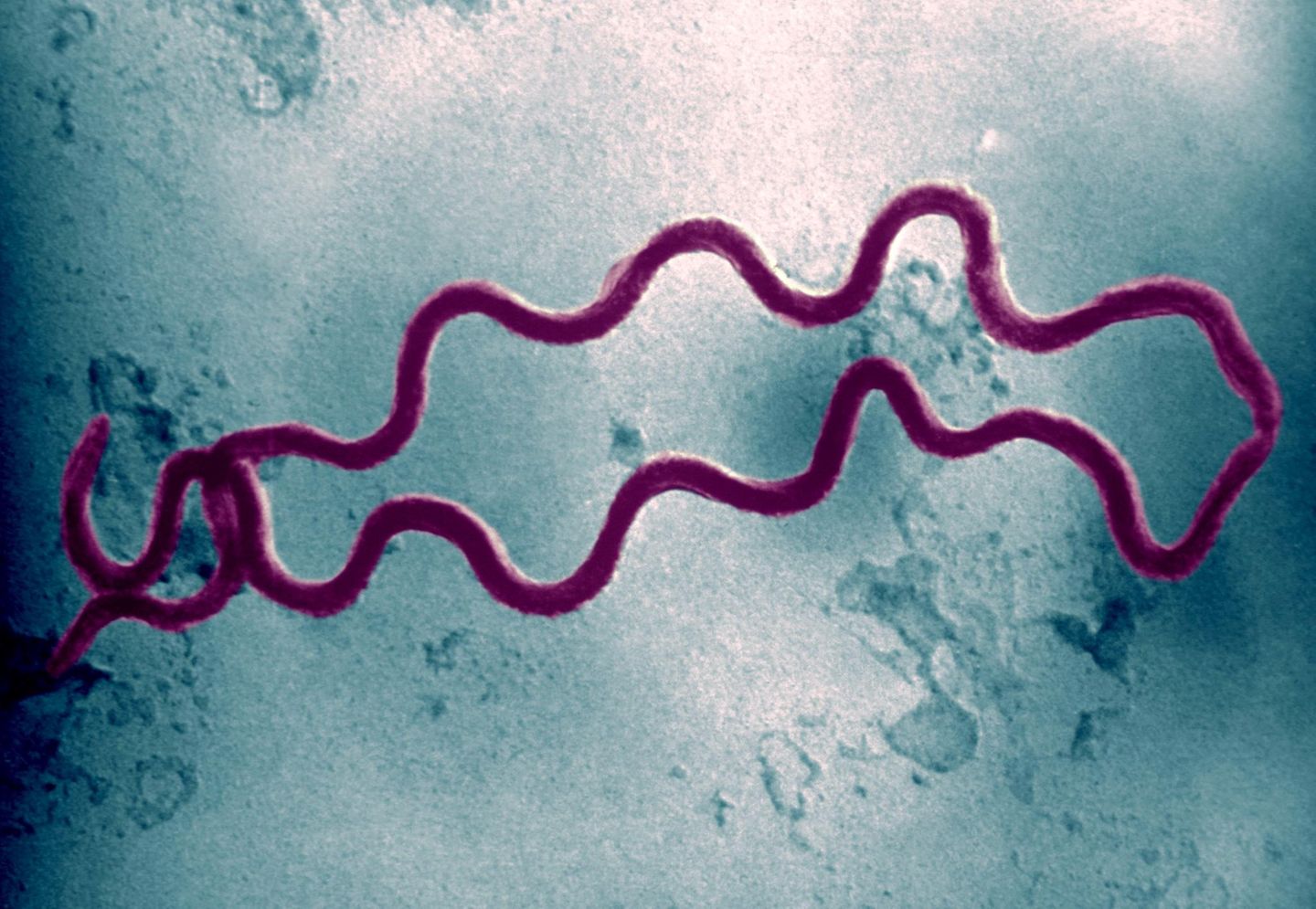 Elektronenmikroskopaufnahme des Bakteriums Treponema Pallidum Bacteria