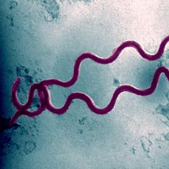 Elektronenmikroskopaufnahme des Bakteriums Treponema Pallidum Bacteria