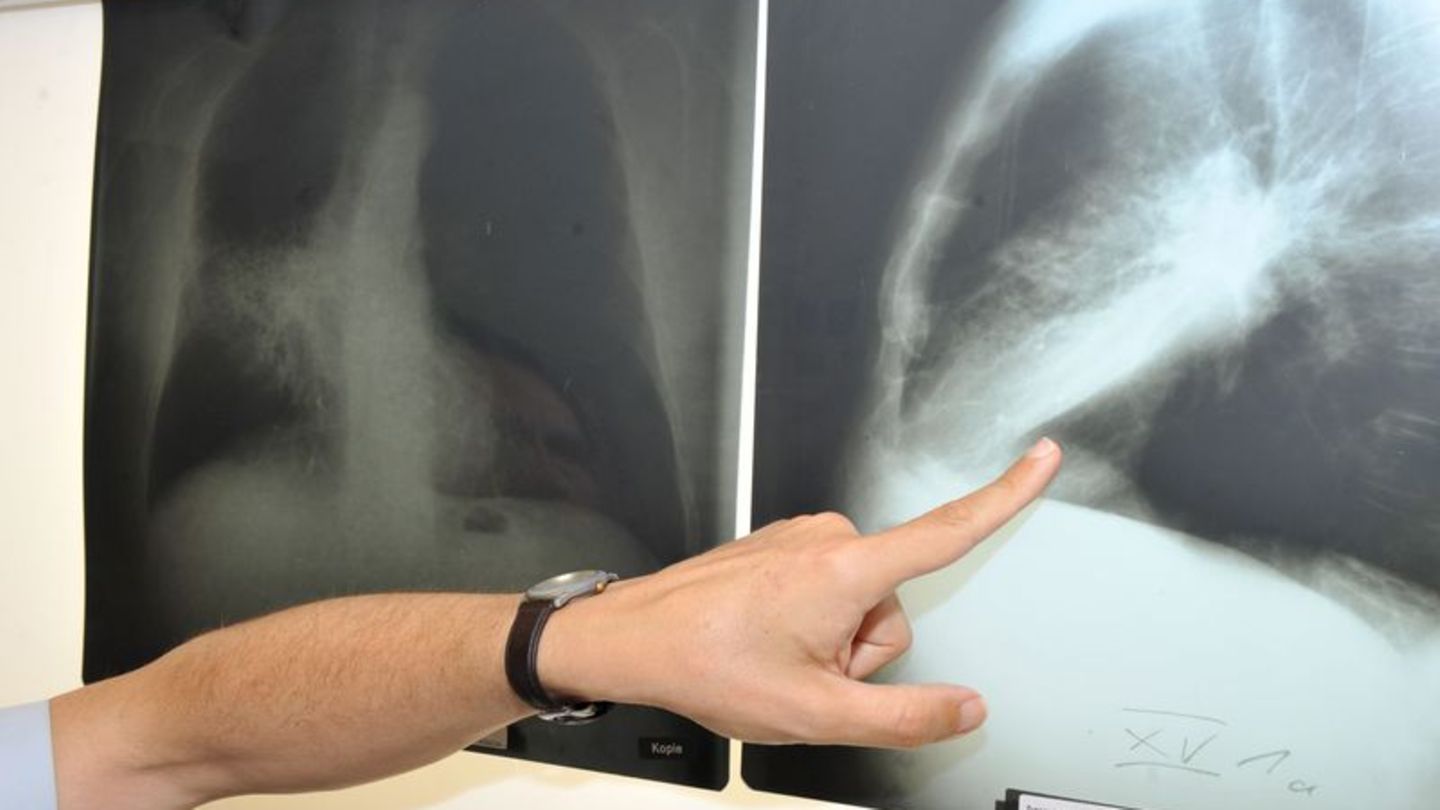 Im Winter weniger zu lüften, kann die Belastung mit krebserregendem Radon in der Wohnung erhöhen. (Archivbild) Foto: Felix Hörha