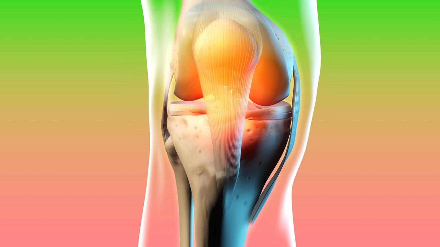 Rheuma-Gicht-Arthrose-Wie-eine-antientz-ndliche-Ern-hrung-bei-Gelenkschmerzen-hilft-GEOplus