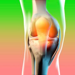 Illustration eines entzündeten Kniegelenks vor farbigem Hintergrund