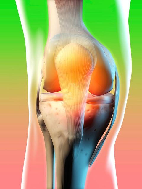Illustration eines entzündeten Kniegelenks vor farbigem Hintergrund