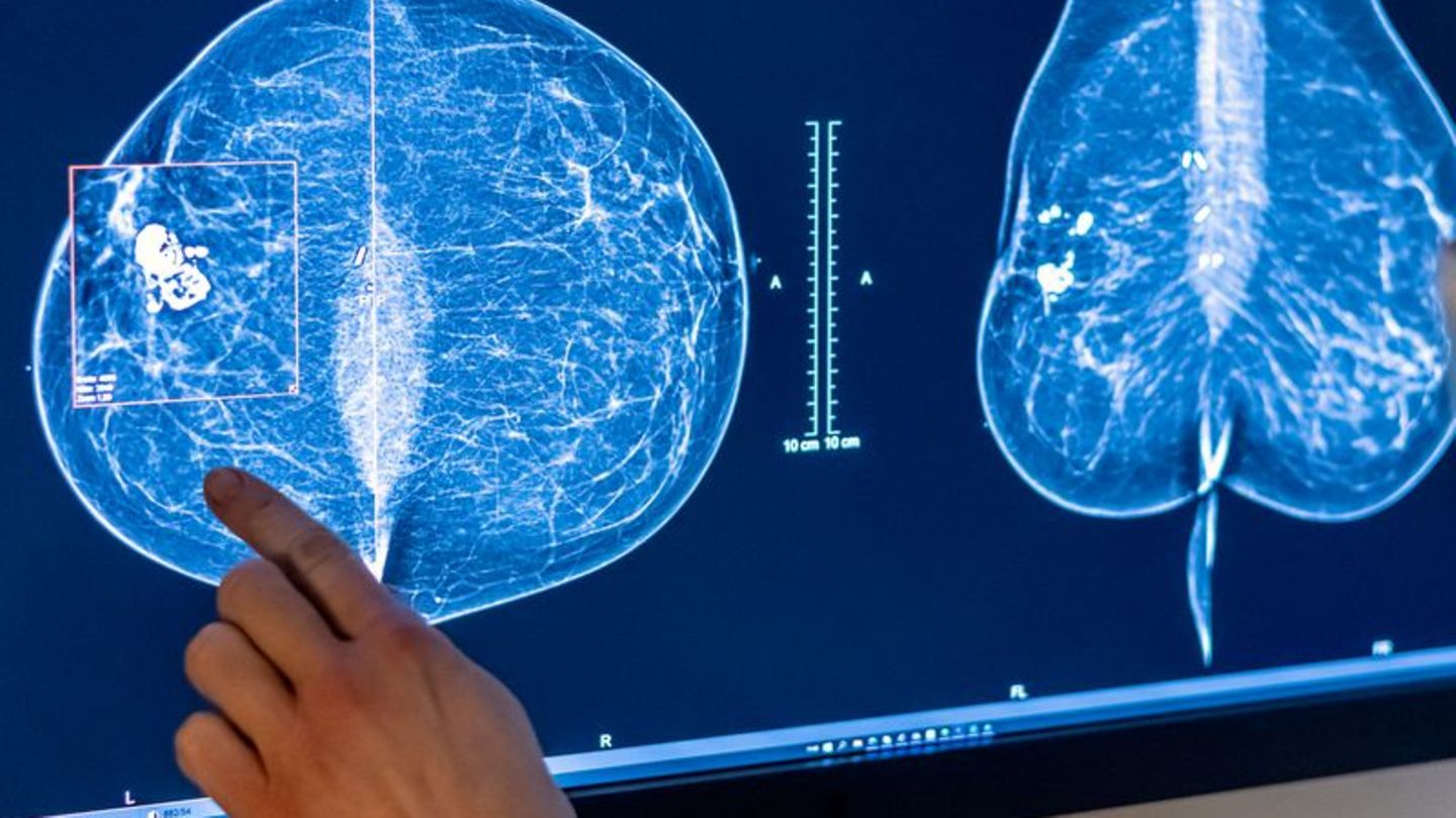 2023 wurden rund eine halbe Million Menschen in Deutschland mit Krebs diagnostiziert. (Symbolbild) Foto: Hannibal Hanschke/dpa