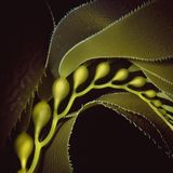 Der Unterwasserfotograf Bruce Hall ist schon lange fasziniert von der Schönheit der Kelpwälder vor der Küste Kaliforniens. Doch gerade die Beschäftigung mit Details der Pflanze stellte ihn vor Herausforderungen: Halls Sehvermögen ist stark eingeschränkt. Mit dieser Nahaufnahme errang er dennoch den vierten Platz in der Kategorie "Makro". 