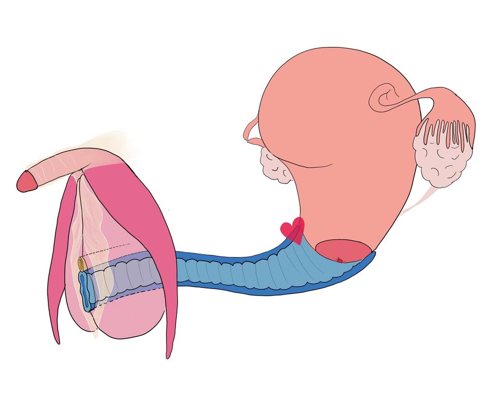 anal stretching plug Digitale Medien prägen den Alltag von Kindern und Jugendlichen und das hat  Folgen für ihren Blick auf Sexualität. Studien zeigen, dass fast die Hälfte  der 11- bis 17-Jährigen bereits Pornos gesehen hat