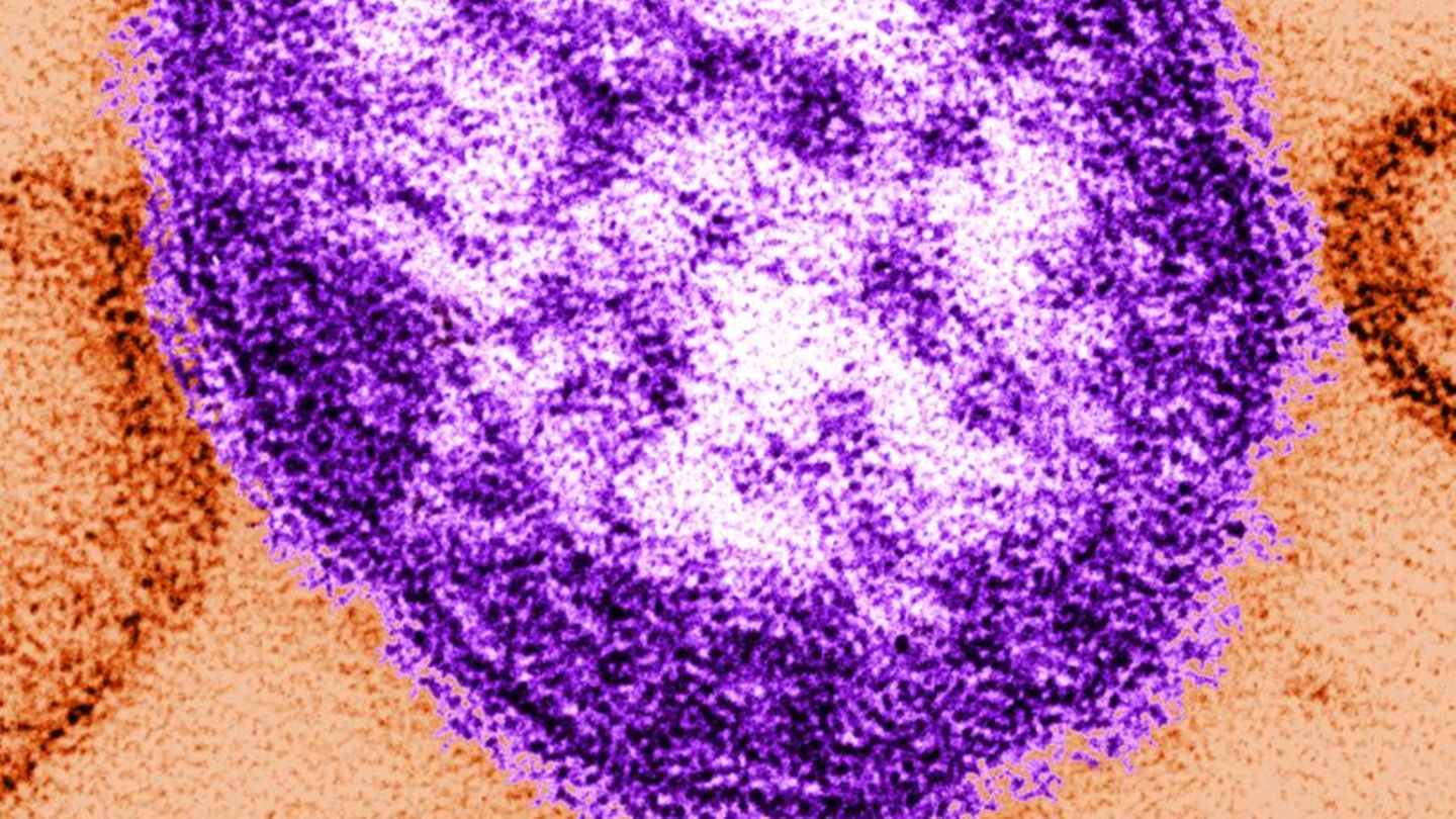 In den USA wurden seit Anfang des Jahres fast 1000 Masern-Fälle gemeldet. Foto: Cynthia Goldsmith/Centers for Disease Contról an