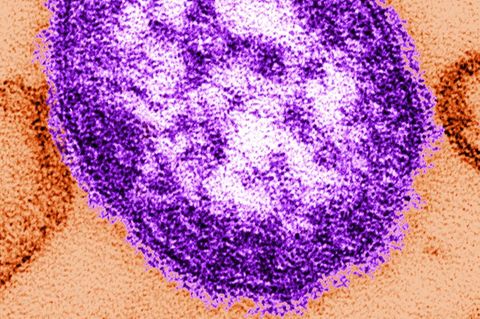 In den USA wurden seit Anfang des Jahres fast 1000 Masern-Fälle gemeldet. Foto: Cynthia Goldsmith/Centers for Disease Contról an