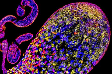 Der einer Fruchtfliege. Die eingefärbten Spermatiden – Vorläufer funktionstüchtiger Spermien – liefern einen Einblick in die Evolution von Drosophila. Im Fokus der Forschung steht das Overdrive-Gen. Es veranlasst die Zerstörung schlechter Spermien, kann sich aber auch gegen gute wenden: Egoistische Chromosomen nutzen es, um Konkurrenten anzugreifen. Indem sie die Entwicklung von Spermien mit anderen Erbanlagen unterbinden, erhöhen sie ihre Chancen, selbst an die nächste Generation weitergegeben zu werden. Ob beim Menschen ein ähnlicher Mechanismus existiert, ist noch nicht bekannt  KW 12