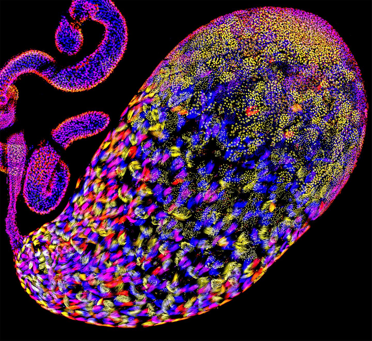 Der einer Fruchtfliege. Die eingefärbten Spermatiden – Vorläufer funktionstüchtiger Spermien – liefern einen Einblick in die Evolution von Drosophila. Im Fokus der Forschung steht das Overdrive-Gen. Es veranlasst die Zerstörung schlechter Spermien, kann sich aber auch gegen gute wenden: Egoistische Chromosomen nutzen es, um Konkurrenten anzugreifen. Indem sie die Entwicklung von Spermien mit anderen Erbanlagen unterbinden, erhöhen sie ihre Chancen, selbst an die nächste Generation weitergegeben zu werden. Ob beim Menschen ein ähnlicher Mechanismus existiert, ist noch nicht bekannt  KW 12