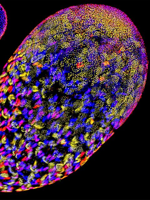 Der einer Fruchtfliege. Die eingefärbten Spermatiden – Vorläufer funktionstüchtiger Spermien – liefern einen Einblick in die Evolution von Drosophila. Im Fokus der Forschung steht das Overdrive-Gen. Es veranlasst die Zerstörung schlechter Spermien, kann sich aber auch gegen gute wenden: Egoistische Chromosomen nutzen es, um Konkurrenten anzugreifen. Indem sie die Entwicklung von Spermien mit anderen Erbanlagen unterbinden, erhöhen sie ihre Chancen, selbst an die nächste Generation weitergegeben zu werden. Ob beim Menschen ein ähnlicher Mechanismus existiert, ist noch nicht bekannt.  KW 12