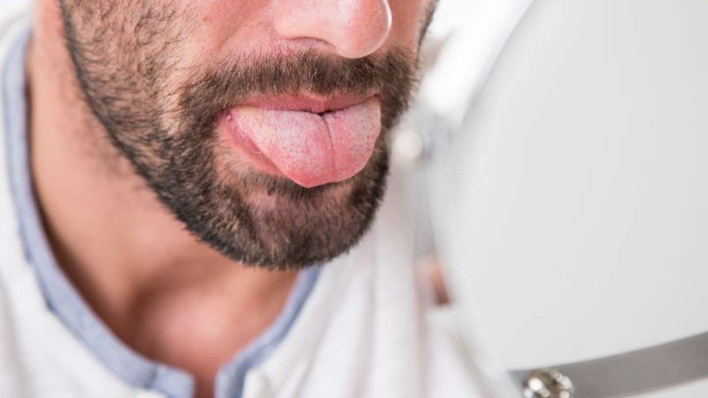 Wer sich regelmäßig gründlich die Zähne putzt und die Zunge mit einem speziellen Schaber reinigt, lässt schädlichen Ablagerungen