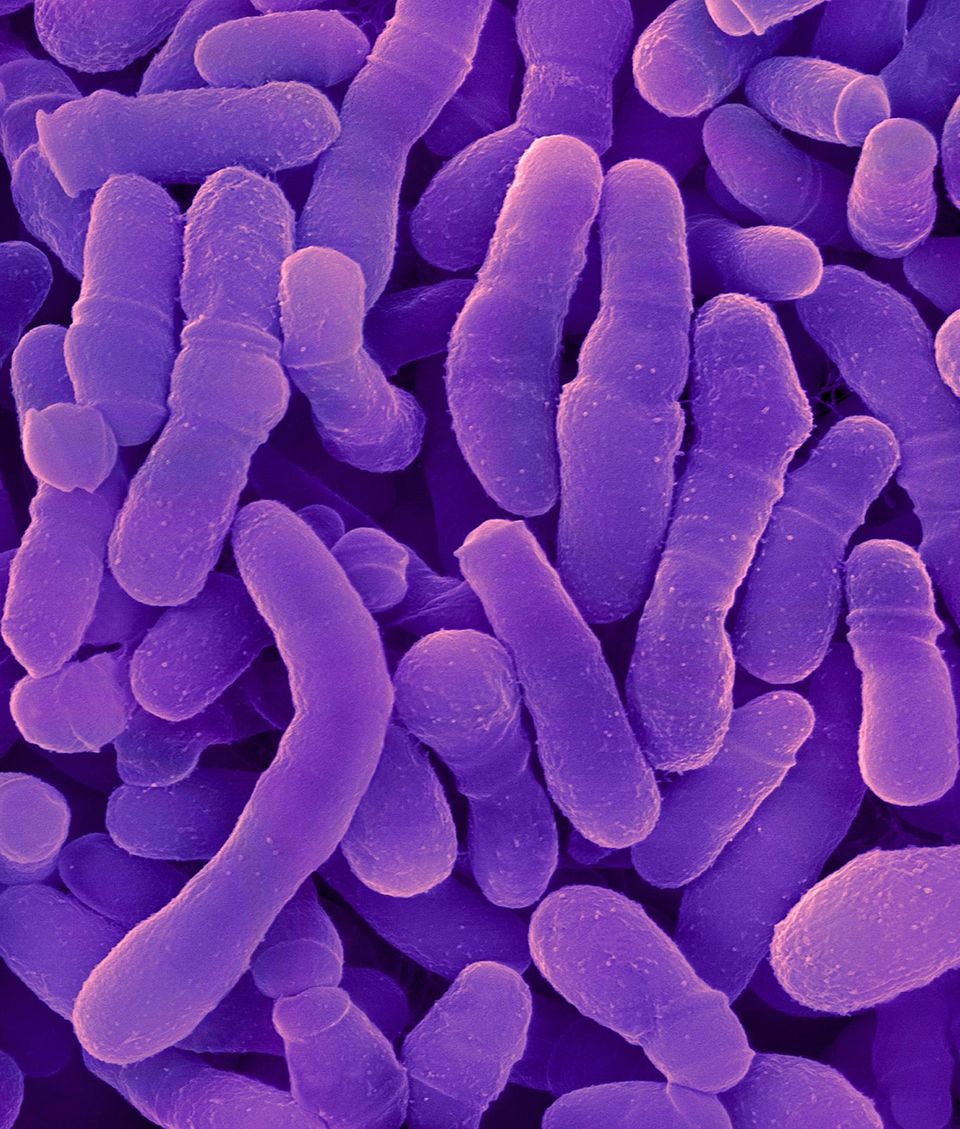 Rasterelektronenmikroskopaufnahme von Corynebacterium tuberculostearicum