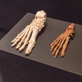 Knochenfunde in der Ausstellung