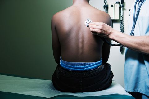 Ein weisshäutiger Arzt hört den Rücken einer dunkelhäutigen Person ab