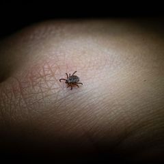 Zecke sitzt auf der Haut