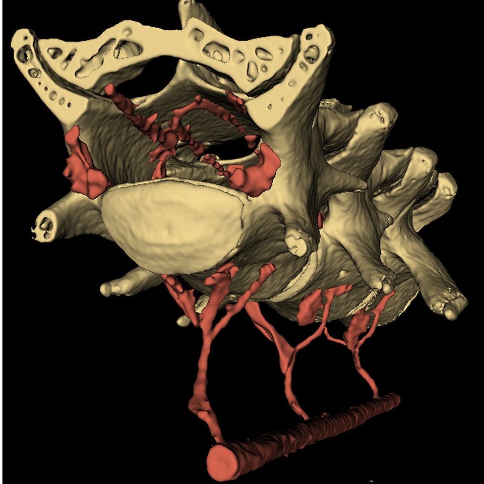 In der Computertomografie von der Wirbelsäule einer Maus werden die Blutgefäße sichtbar, die eine hydraulische Verbindung zwischen Bauchraum und Gehirn herstellen