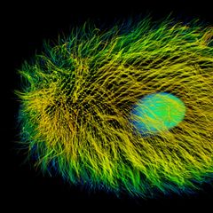 Dasytricha ruminantium unter dem Fluoreszenzmikroskop; im Innern leuchtet der Zellkern. Das Wimpertierchen gedeiht in Kuhmägen und liefert den Wasserstoff zur Methan-Synthese